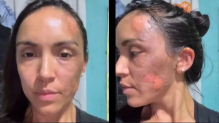 La hermana de un influencer fue atacada en un partido de hockey frente a su hija